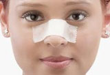 Nose Surgery Recovery